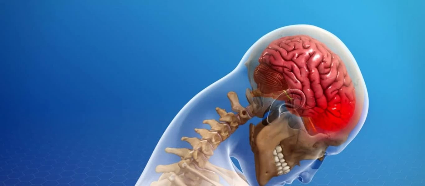 Αυχενογενής πονοκέφαλος: Αίτια, συμπτώματα και πως να τον αντιμετωπίσετε